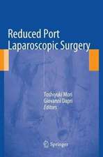 Reduced Port Laparoscopic Surgery