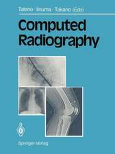 Computed Radiography