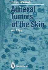 Adnexal Tumors of the Skin: An Atlas