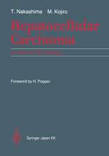 Hepatocellular Carcinoma: An Atlas of Its Pathology