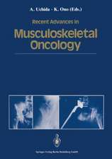 Recent Advances in Musculoskeletal Oncology