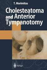 Cholesteatoma and Anterior Tympanotomy