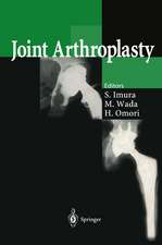 Joint Arthroplasty