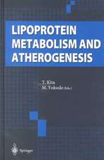 Lipoprotein Metabolism and Atherogenesis