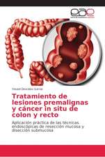 Tratamiento de lesiones premalignas y cáncer in situ de colon y recto