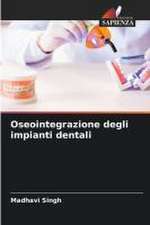 Oseointegrazione degli impianti dentali