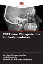 CBCT dans l'imagerie des implants dentaires