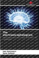 The electroencephalogram