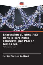 Expression du gène P53 dans le carcinome colorectal par PCR en temps réel