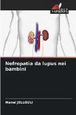 Nefropatia da lupus nei bambini