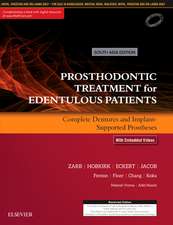 Prosthodontic Treatment for Edentulous Patients: Complete Dentures and Implant-Supported Prostheses: 1st South Asia Edition