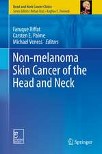 Non-melanoma Skin Cancer of the Head and Neck