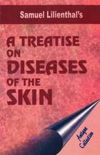 Treatise on Diseases of the Skin