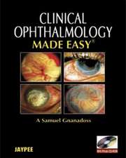 Clinical Ophthalmology Made Easy