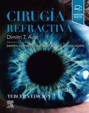 Cirugia Refractiva