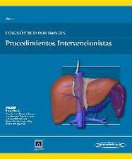 Diagnóstico por imagen : procedimientos intervencionistas