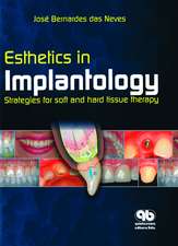 Esthetics in Implantology: Strategies for Soft and Hard Tissue Therapy