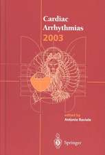 Cardiac Arrhythmias 2003: Proceedings of the 8th International Workshop on Cardiac Arrhythmias