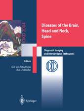 Diseases of the Brain, Head and Neck, Spine: Diagnostic Imaging and Interventional Techniques