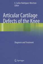 Articular Cartilage Defects of the Knee: Diagnosis and Treatment