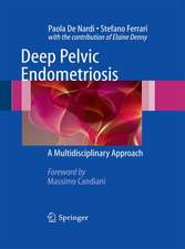 Deep Pelvic Endometriosis: A Multidisciplinary Approach