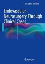 Endovascular Neurosurgery Through Clinical Cases