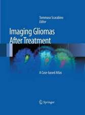 Imaging Gliomas After Treatment: A Case-based Atlas