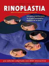 Rinoplastia