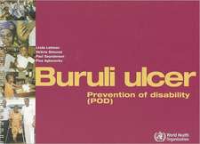 Buruli Ulcer: Prevention of Disability (POD)