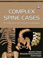 Complex Spine Cases