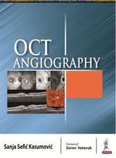 OCT Angiography