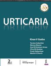 Urticaria