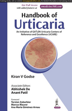 Handbook of Urticaria: An Initiative of GA2LEN Urticaria Centers of Reference and Excellence (UCARE)