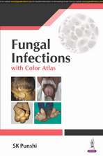 Fungal Infections: with Color Atlas