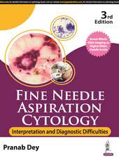 Fine Needle Aspiration Cytology: Interpretation and Diagnostic Difficulties