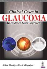 Clinical Cases in Glaucoma: An Evidence Based Approach