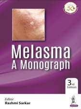 Melasma: A Monograph