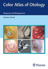 Color Atlas of Otology – Diagnosis and Management