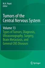 Tumors of the Central Nervous System, Volume 13: Types of Tumors, Diagnosis, Ultrasonography, Surgery, Brain Metastasis, and General CNS Diseases