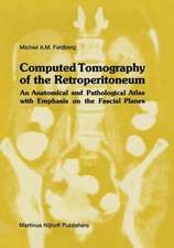 Computed Tomography of the Retroperitoneum: An Anatomical and Pathological Atlas with Emphasis on the Fascial Planes