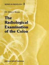 The Radiological Examination of the Colon: Practical Diagnosis