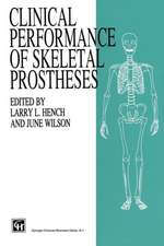 Clinical Performance of Skeletal Prostheses