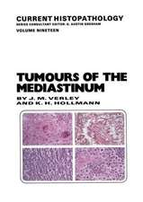 Tumours of the Mediastinum