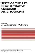 State of the Art in Quantitative Coronary Arteriography