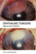 Ophthalmic Tumours