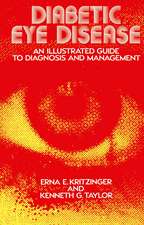 Diabetic Eye Disease: An Illustrated Guide to Diagnosis and Management