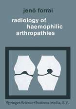 Radiology of Haemophilic Arthropathies