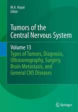 Tumors of the Central Nervous System, Volume 13: Types of Tumors, Diagnosis, Ultrasonography, Surgery, Brain Metastasis, and General CNS Diseases