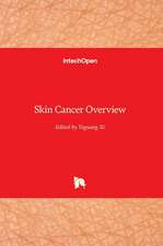 Skin Cancer Overview