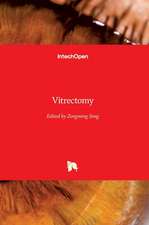 Vitrectomy